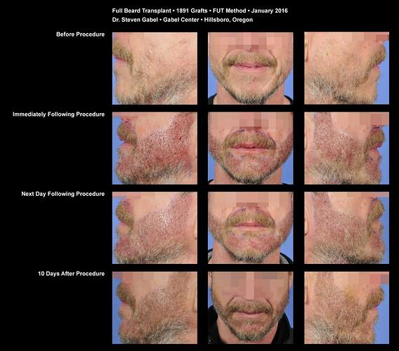 Beard-sheet
