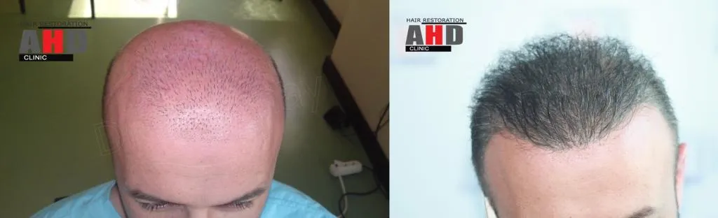 875d9e26-9012-4ce4-b2db-2d0fa8aab152