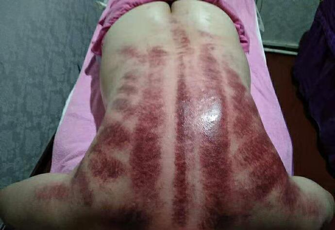 backscrape
